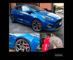 PINZE IMPIANTO FRENI MAGGIORATI FORD FIESTA ST MK8